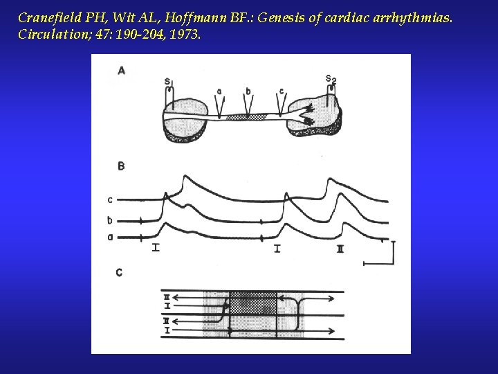 Cranefield PH, Wit AL, Hoffmann BF. : Genesis of cardiac arrhythmias. Circulation; 47: 190