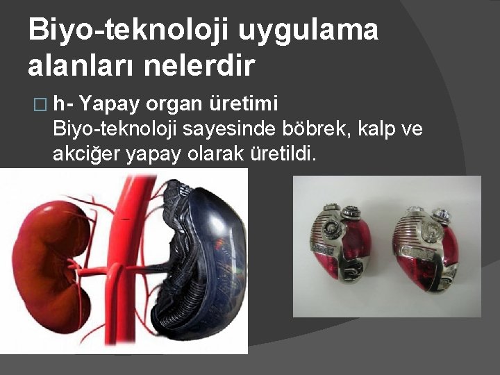 Biyo-teknoloji uygulama alanları nelerdir � h- Yapay organ üretimi Biyo-teknoloji sayesinde böbrek, kalp ve