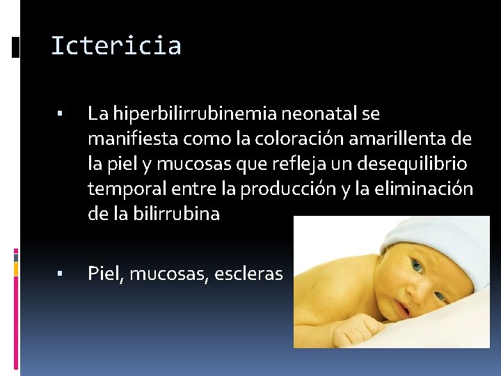 Ictericia ▪ La hiperbilirrubinemia neonatal se manifiesta como la coloración amarillenta de la piel