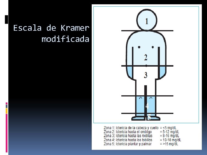 Escala de Kramer modificada 