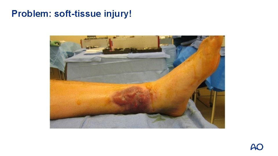Problem: soft-tissue injury! 
