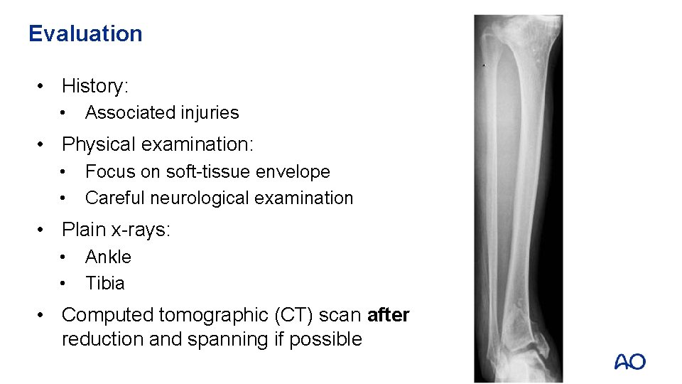 Evaluation • History: • Associated injuries • Physical examination: • • Focus on soft-tissue