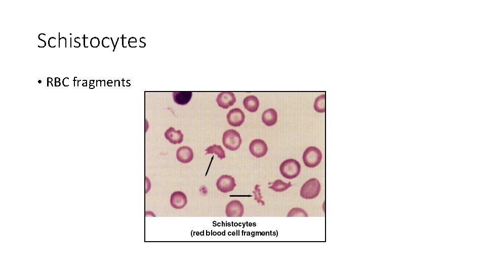 Schistocytes • RBC fragments 