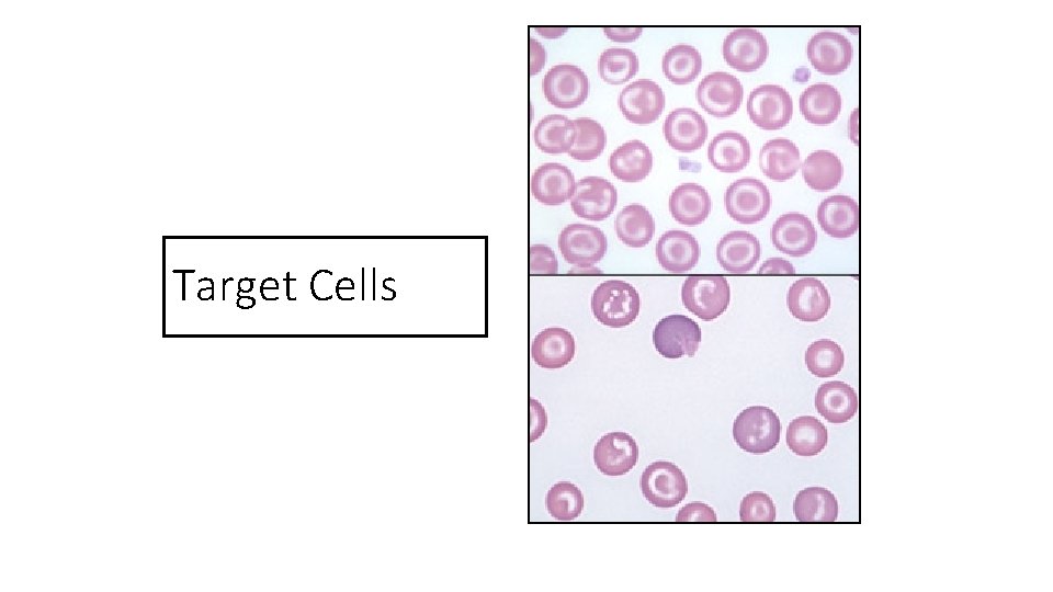 Target Cells 