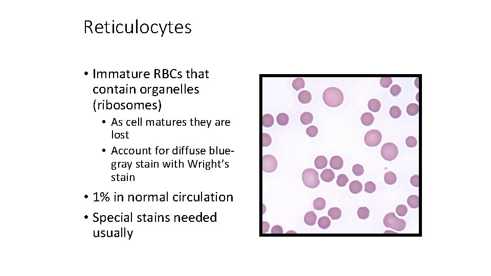 Reticulocytes • Immature RBCs that contain organelles (ribosomes) • As cell matures they are