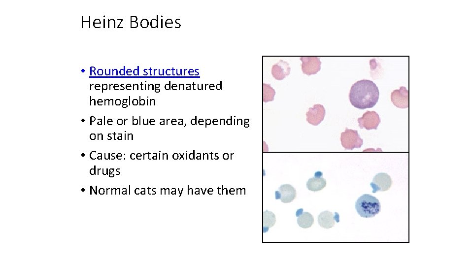 Heinz Bodies • Rounded structures representing denatured hemoglobin • Pale or blue area, depending