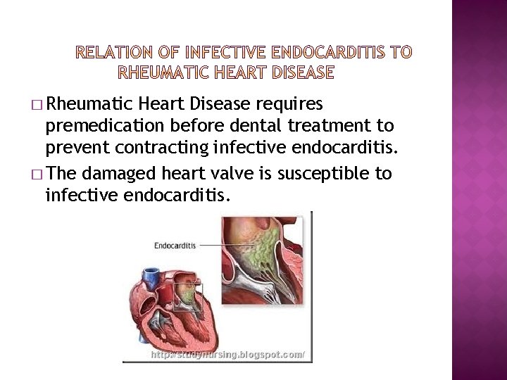 � Rheumatic Heart Disease requires premedication before dental treatment to prevent contracting infective endocarditis.