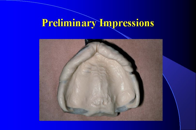 Preliminary Impressions 