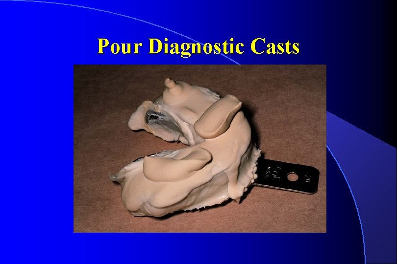 Pour Diagnostic Casts 