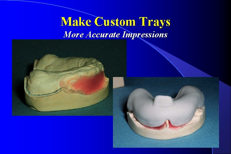 Make Custom Trays More Accurate Impressions 