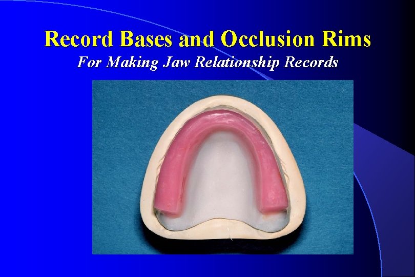 Record Bases and Occlusion Rims For Making Jaw Relationship Records 