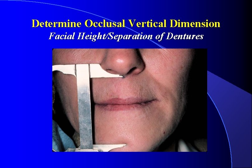 Determine Occlusal Vertical Dimension Facial Height/Separation of Dentures 