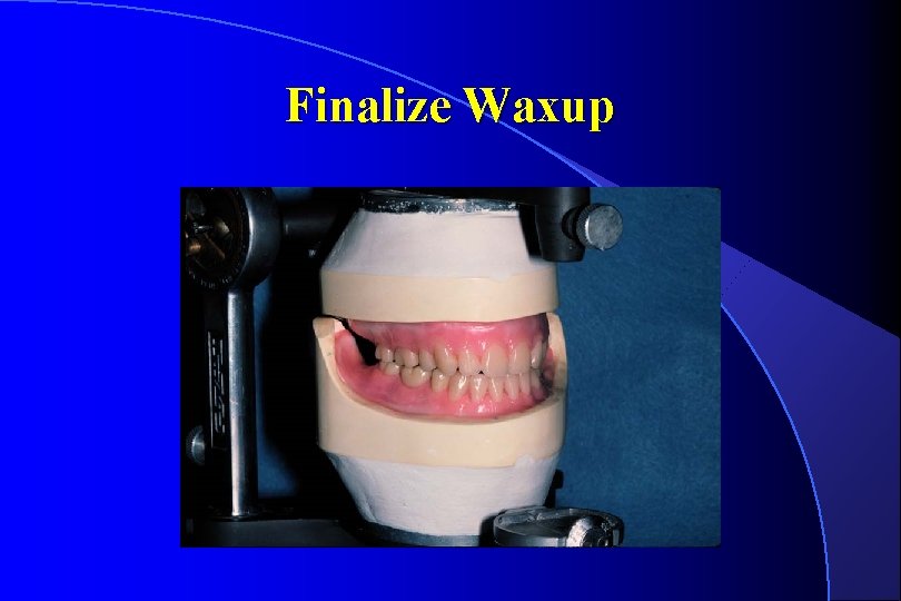 Finalize Waxup 