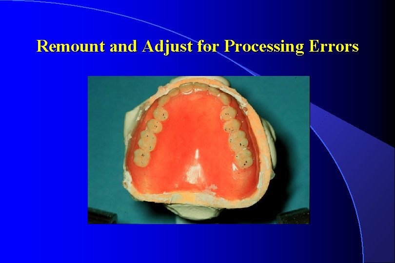 Remount and Adjust for Processing Errors 
