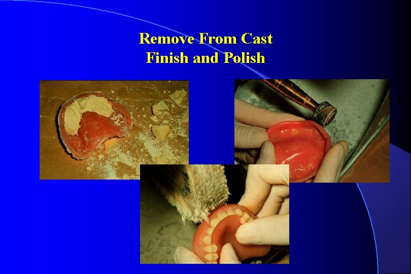 Remove From Cast Finish and Polish 