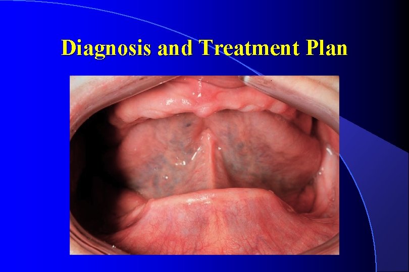 Diagnosis and Treatment Plan 