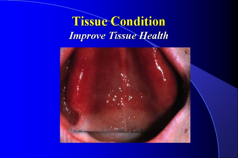 Tissue Condition Improve Tissue Health 