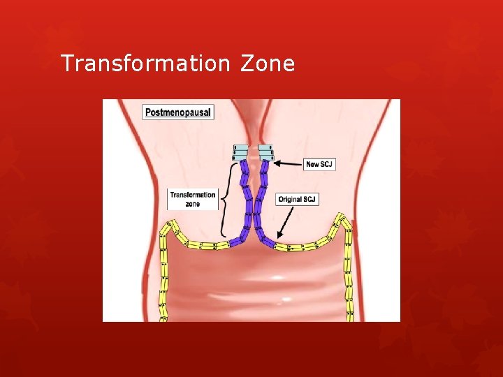 Transformation Zone 