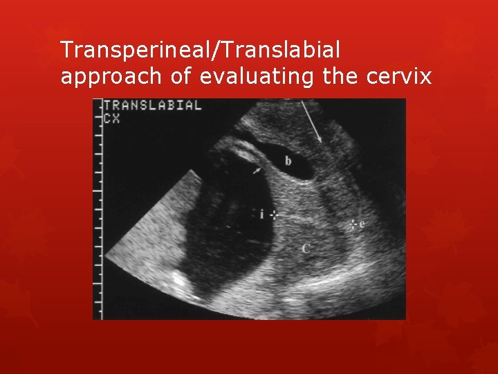 Transperineal/Translabial approach of evaluating the cervix 