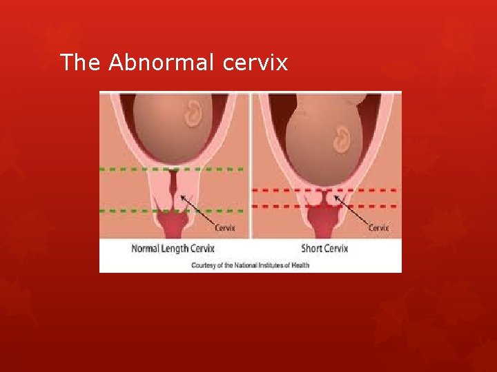 The Abnormal cervix 