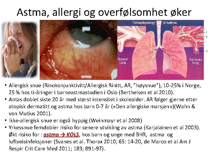 Astma, allergi og overfølsomhet øker • Allergisk snue (Rinokonjunktivitt/Allergisk Rinitt, AR, ”høysnue”), 10 -25%