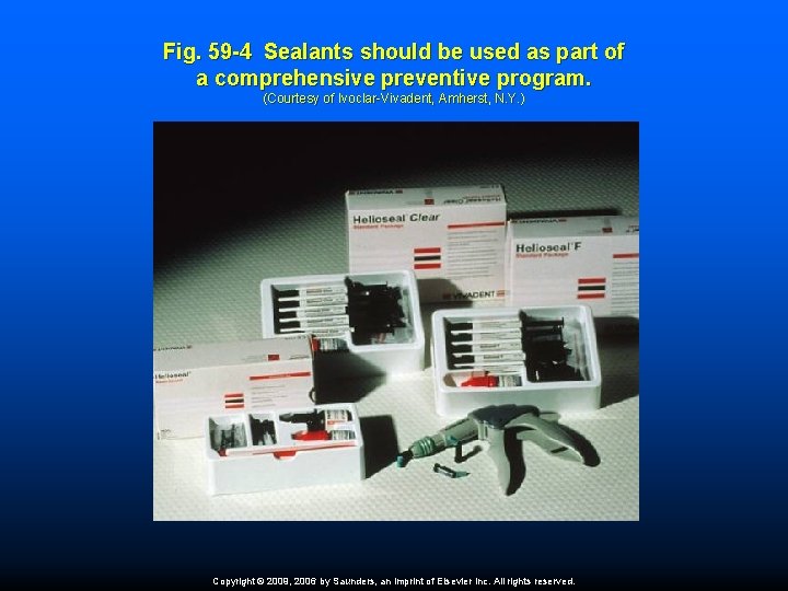 Fig. 59 -4 Sealants should be used as part of a comprehensive preventive program.