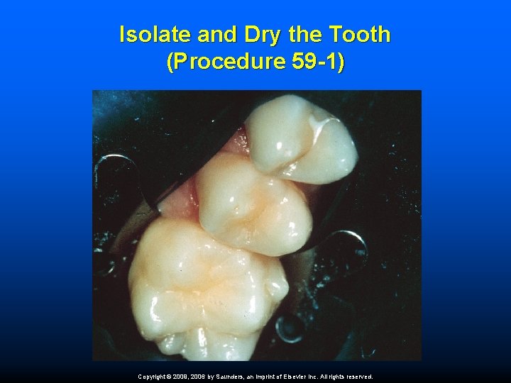 Isolate and Dry the Tooth (Procedure 59 -1) Copyright © 2009, 2006 by Saunders,