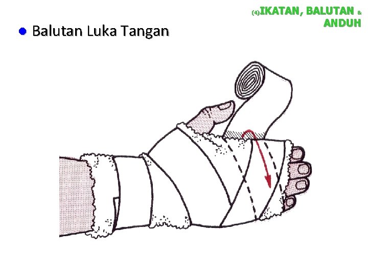 IKATAN, BALUTAN & ANDUH (4) l Balutan Luka Tangan 