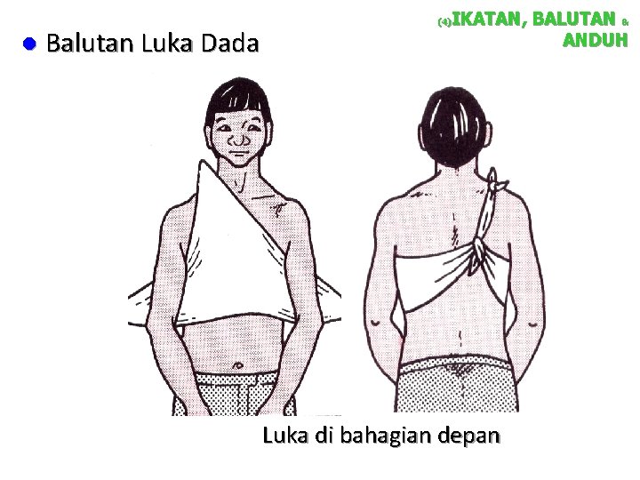 l Balutan Luka Dada IKATAN, BALUTAN & ANDUH (4) Luka di bahagian depan 