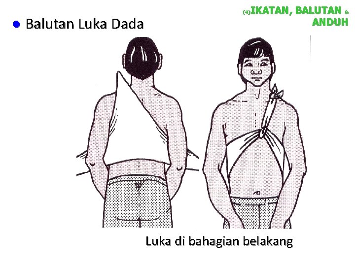 l Balutan Luka Dada IKATAN, BALUTAN & ANDUH (4) Luka di bahagian belakang 