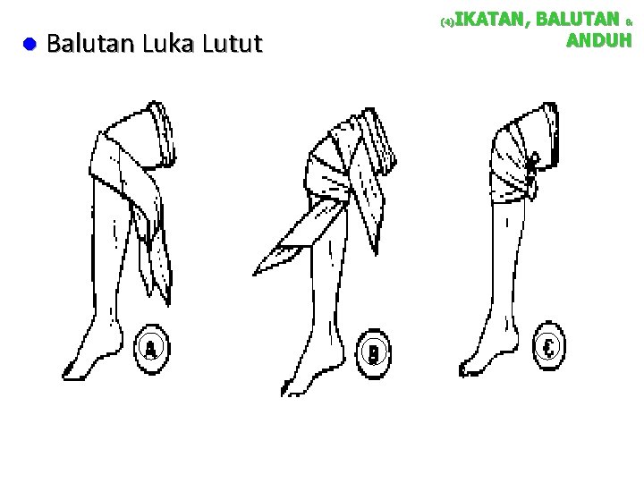 l IKATAN, BALUTAN & ANDUH (4) Balutan Luka Lutut 1 2 3 