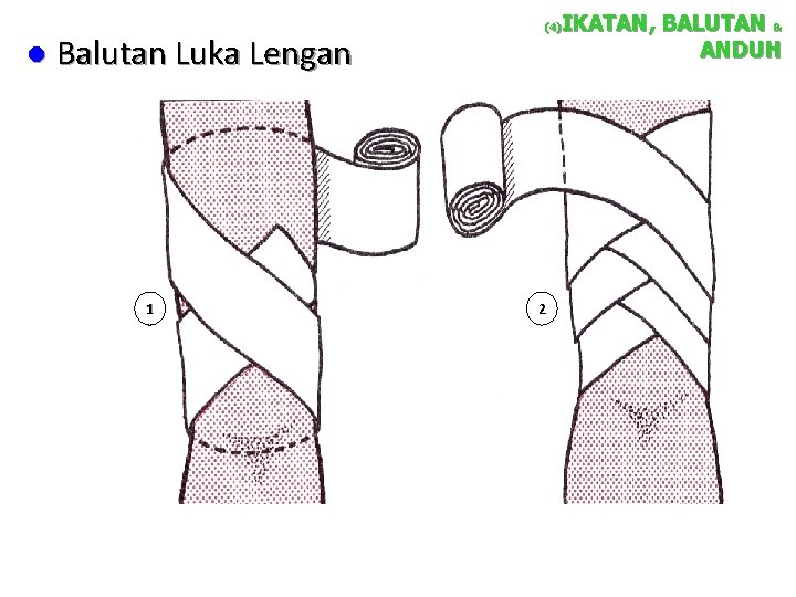 l Balutan Luka Lengan 1 IKATAN, BALUTAN & ANDUH (4) 2 