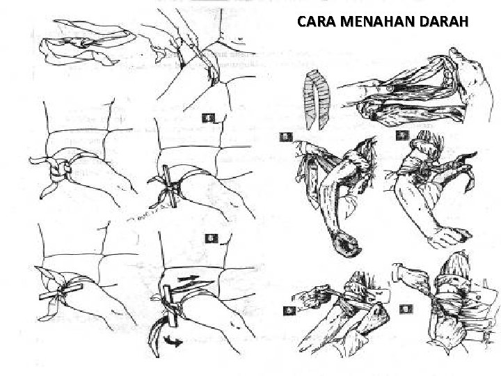 CARA MENAHAN DARAH 