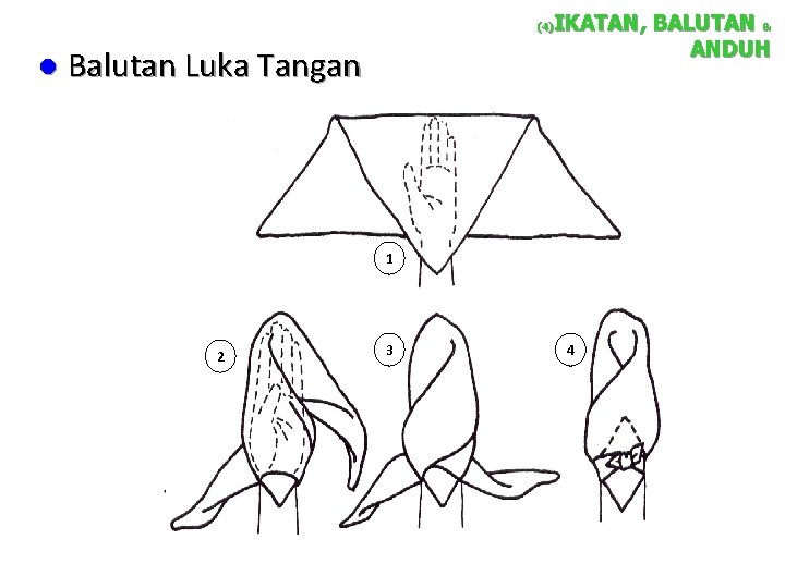 IKATAN, BALUTAN & ANDUH (4) l Balutan Luka Tangan 1 2 3 4 