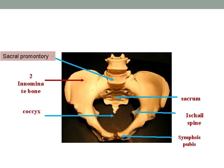 Sacral promontory • 2 Innomina te bone sacrum coccyx Ischail spine Symphsis pubis 