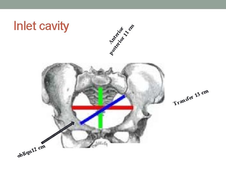 po An ste te rio r 1 c m Inlet cavity m c 3