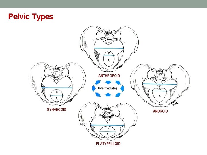 Pelvic Types 