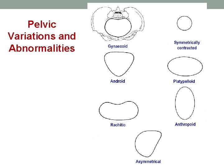 Pelvic Variations and Abnormalities 