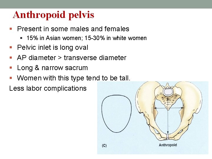 Anthropoid pelvis § Present in some males and females § 15% in Asian women;
