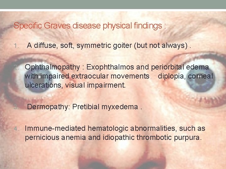 Specific Graves disease physical findings : 1. A diffuse, soft, symmetric goiter (but not