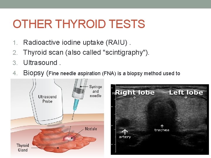 OTHER THYROID TESTS 1. Radioactive iodine uptake (RAIU). 2. Thyroid scan (also called "scintigraphy").