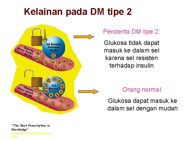 Kelainan pada DM tipe 2 Penderita DM tipe 2: Glukosa tidak dapat masuk ke