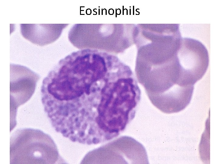 Eosinophils 