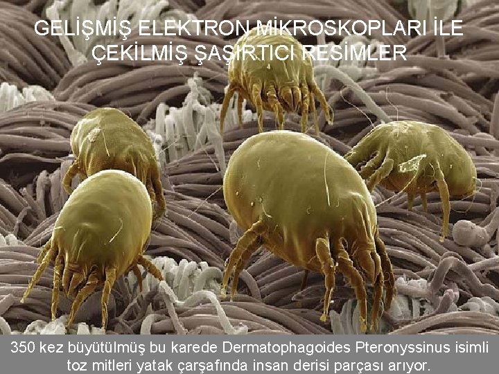 GELİŞMİŞ ELEKTRON MİKROSKOPLARI İLE ÇEKİLMİŞ ŞAŞIRTICI RESİMLER 350 kez büyütülmüş bu karede Dermatophagoides Pteronyssinus
