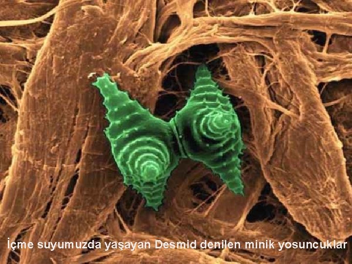 İçme suyumuzda yaşayan Desmid denilen minik yosuncuklar 