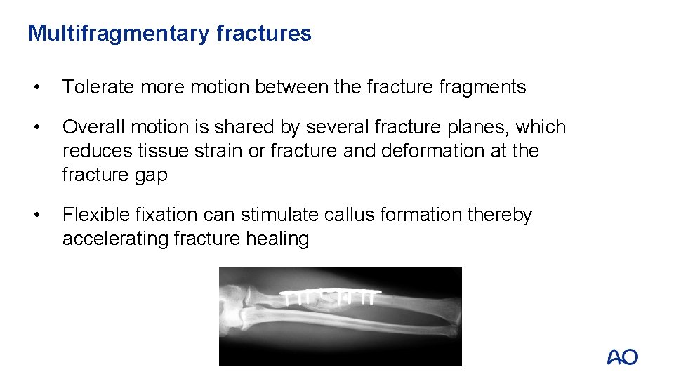 Multifragmentary fractures • Tolerate more motion between the fracture fragments • Overall motion is