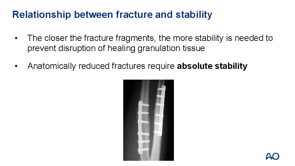 Relationship between fracture and stability • The closer the fracture fragments, the more stability