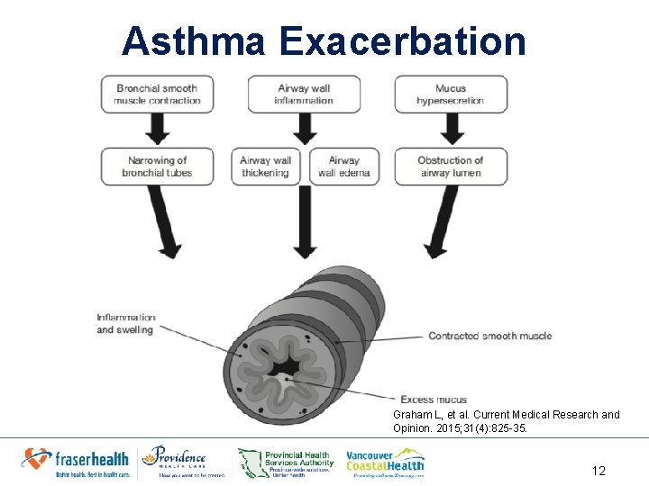 Asthma Exacerbation Graham L, et al. Current Medical Research and Opinion. 2015; 31(4): 825