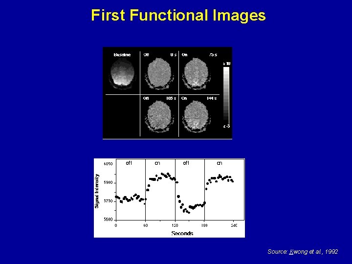 First Functional Images Source: Kwong et al. , 1992 