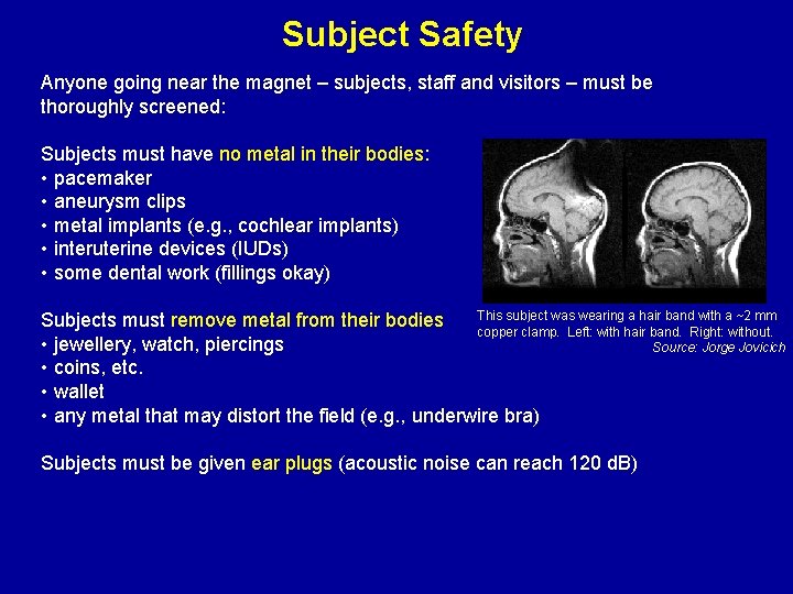 Subject Safety Anyone going near the magnet – subjects, staff and visitors – must